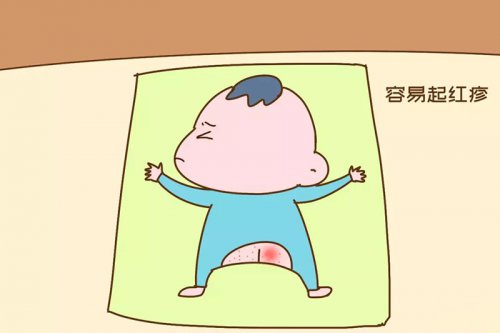 夏天宝宝红屁股全怪尿不湿？这锅，尿不湿不背！